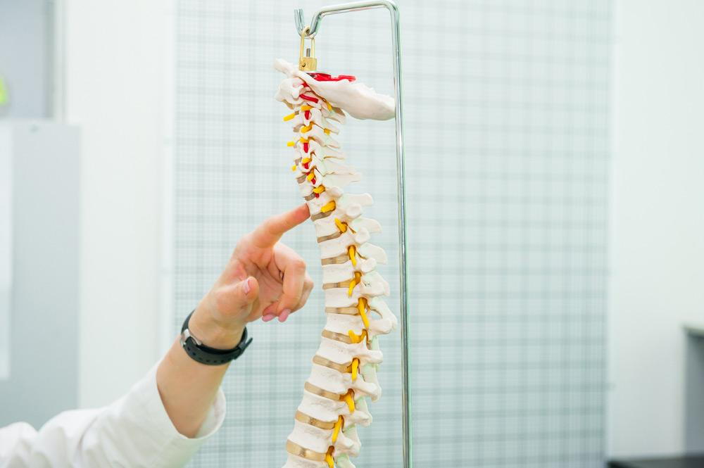 What Is Scoliosis: A Simple Explanation for Patients and Families